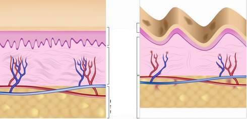 Các sợi collagen giúp cho da không bị chùng nhão.